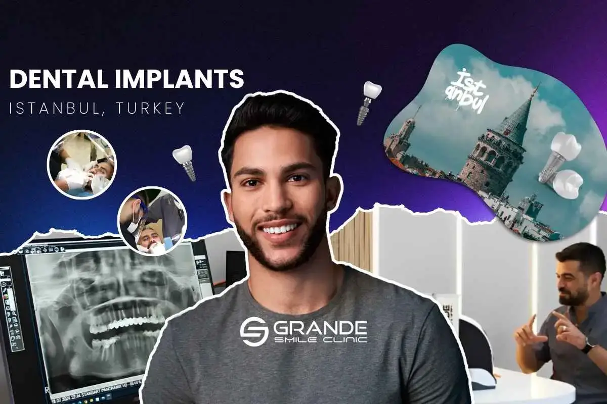 Dental Implants Turkey