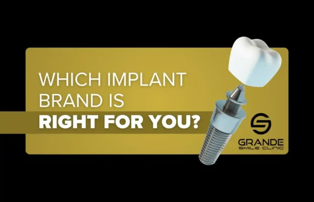 Which Implant Brand is Right for You?