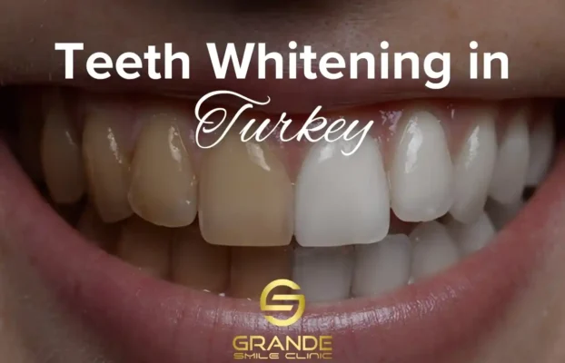 Teeth Whitening in Turkey: Cost, Process, and Benefits