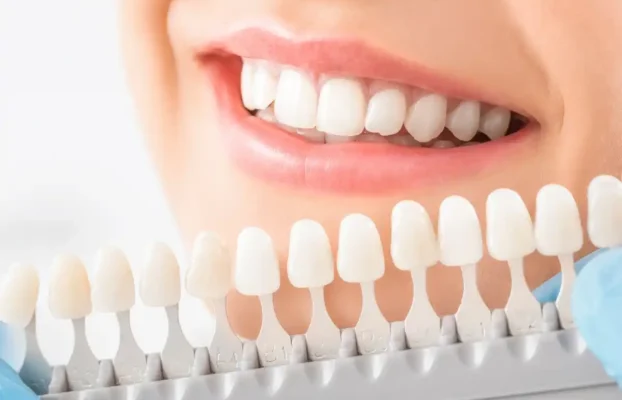 Debunking Common Myths About Dental Crowns