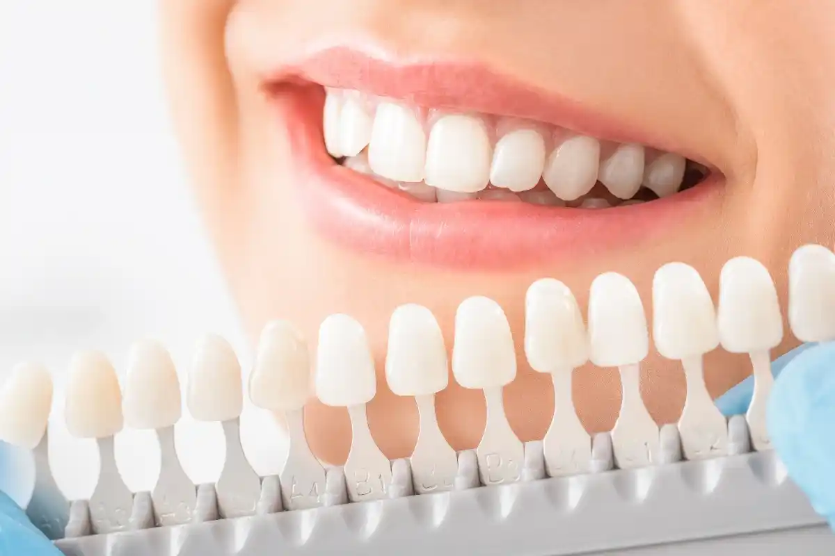 Debunking Common Myths About Dental Crowns