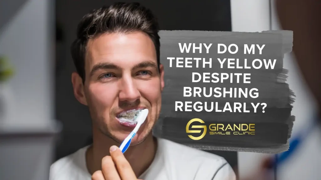 teeth yellowing despite brushing teeth