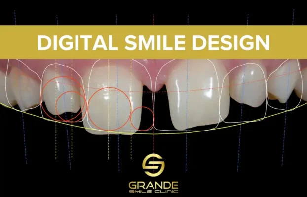 Digital Smile Design: Revolutionizing Aesthetic Dentistry