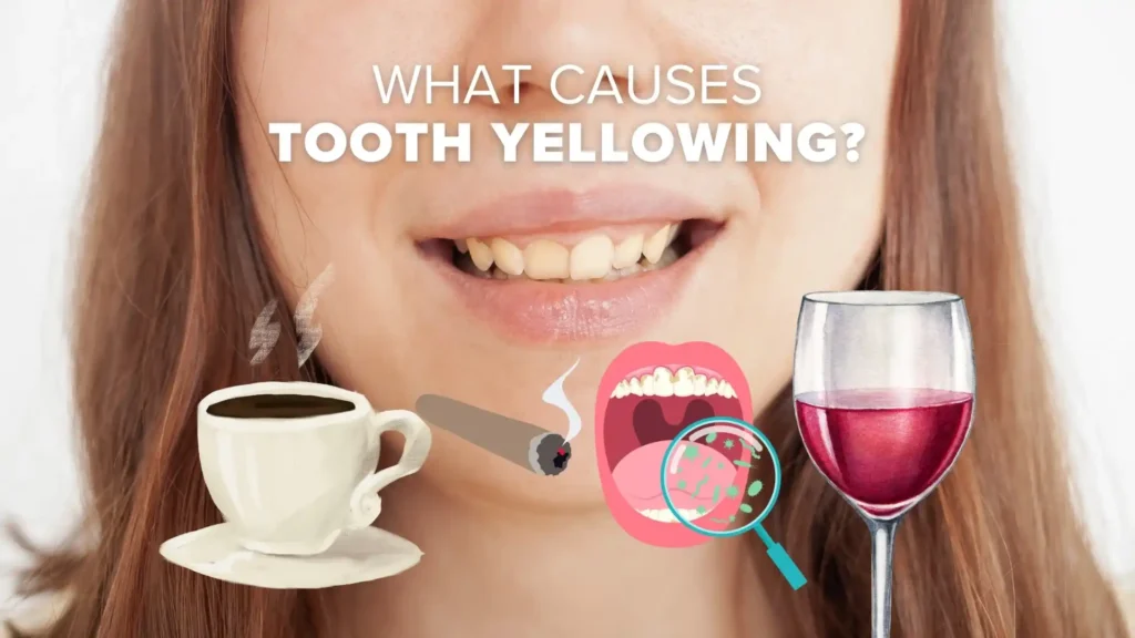 causes of tooth yellowing. red wine, smoking, coffee and poor mouth hygiene