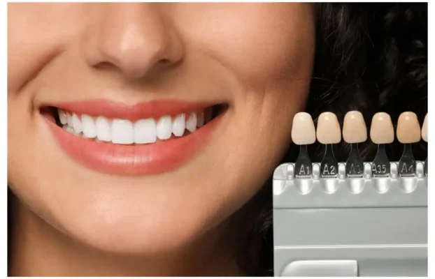 Dental Crowns and Veneers: Zirconia, E-Max, and More