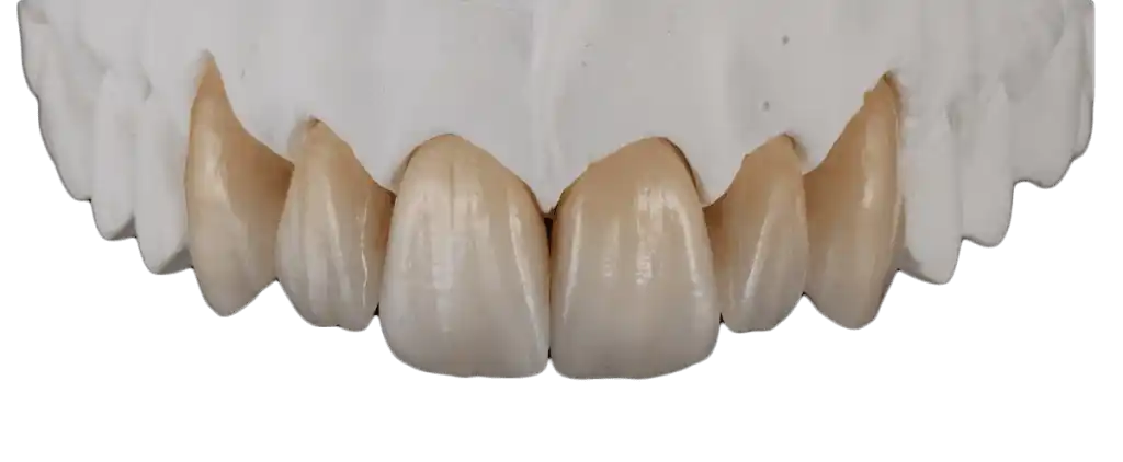 monolithic zirconia teeth