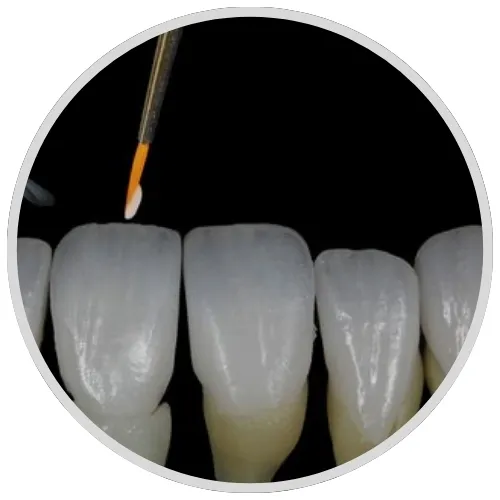 5) Application of Natural Shade Transitions