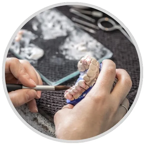 4) Ceramic Layering