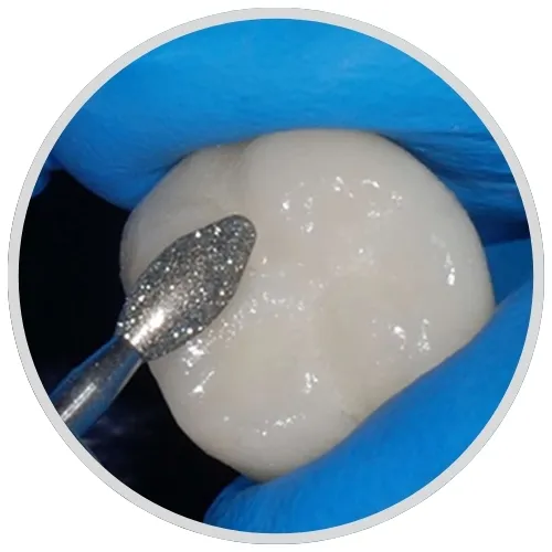 6) Final Polishing and Surface Glazing